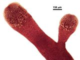 7 - Sori di tetrasporocisti in visione superficiale